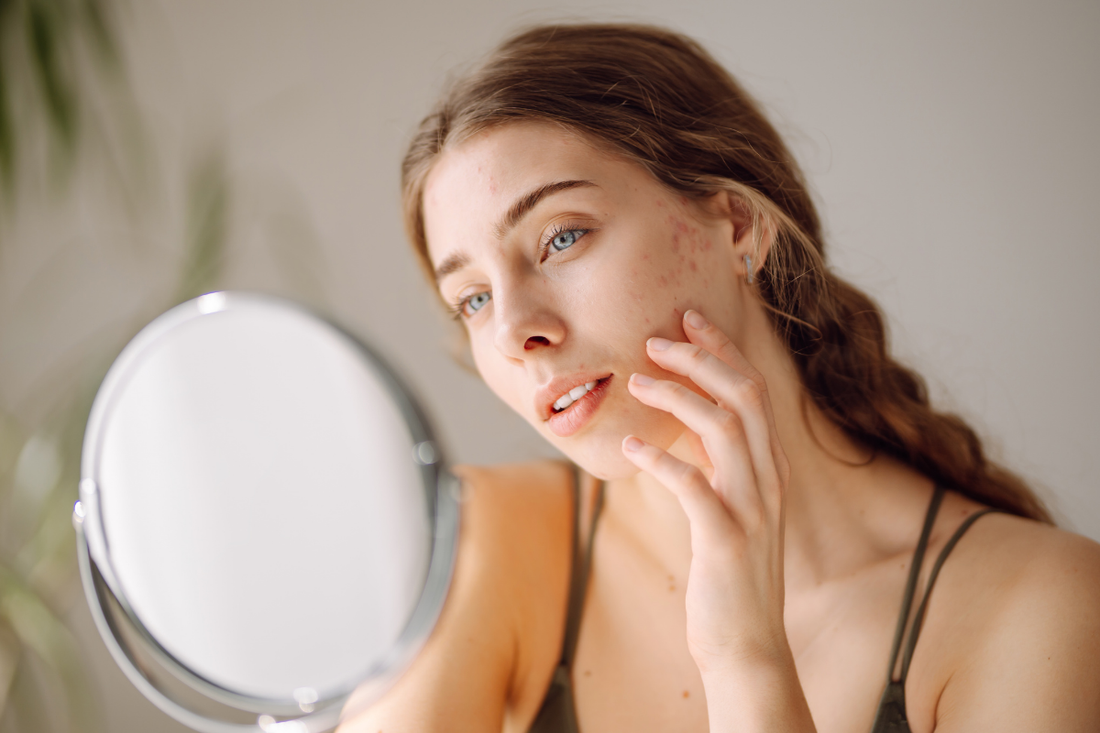 Why is my skin breaking out after I changed my routine?